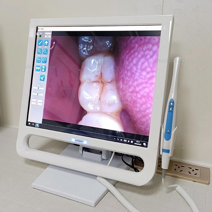 Magenta YF-1700P+ Dental 17 Inch Touch Screen Intraoral Camera